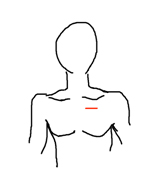 médiastin-3